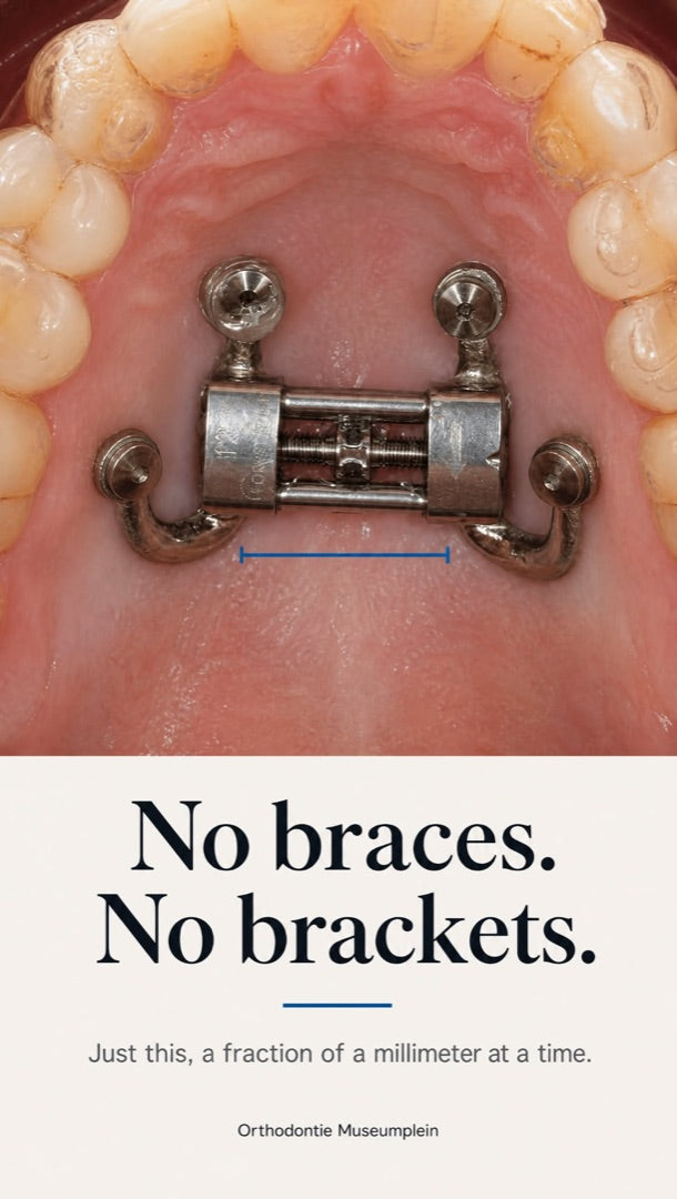 Advertentie van Orthodontie Museumplein